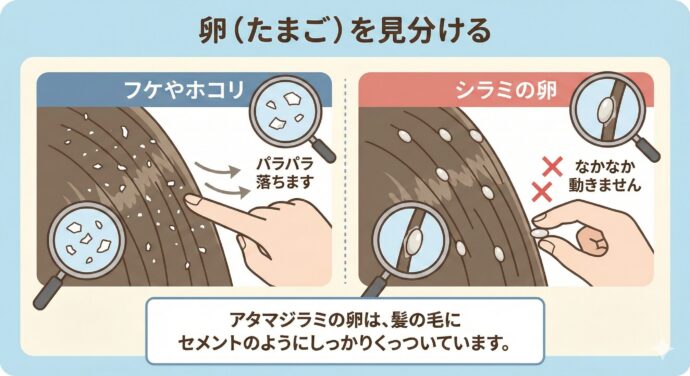 アタマジラミ”すぐくる”