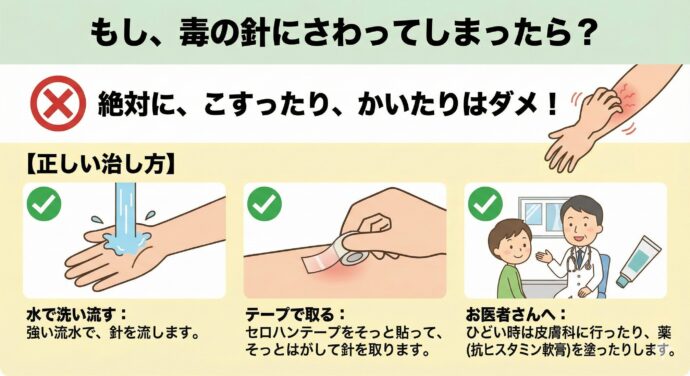 もし、毒の針にさわってしまったら?
ここが一番大事です!もし「かゆい!」と思っても…
絶対に、こすったり、かいたりはダメ!!
こすると、毒の針が皮膚(ひふ)の奥(おく)に刺さって、もっとひどくなってしまいます。
【正しい治し方】
水で洗い流す: 強い流水(りゅうすい)で、針を流します。
テープで取る: 刺さった場所がわかるときは、セロハンテープをそっと貼(は)って、そっとはがして針を取ります。(強く押すとダメだよ)
お医者さんへ: ひどい時は皮膚科(ひふか)に行ったり、薬(抗ヒスタミン軟膏)を塗ったりします。